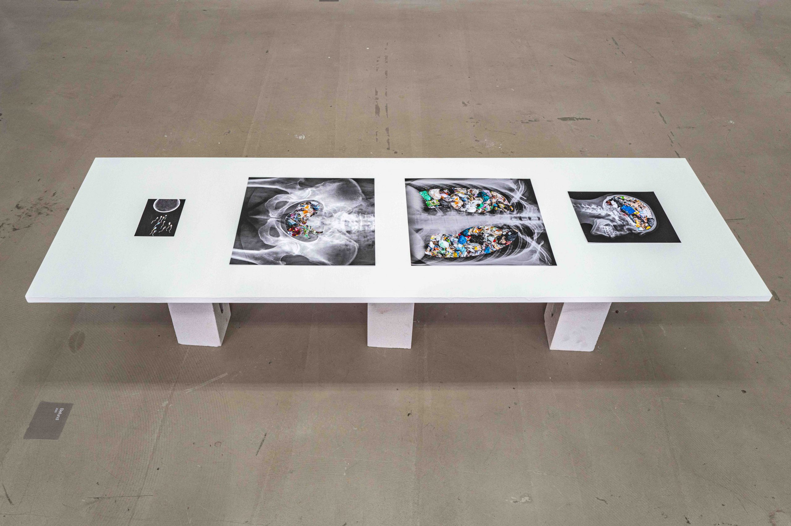 Ferien am Meer L1040740 Mikroplastik im menschlichen Körper Gehirn, Lunge, Plazenta, Spermien